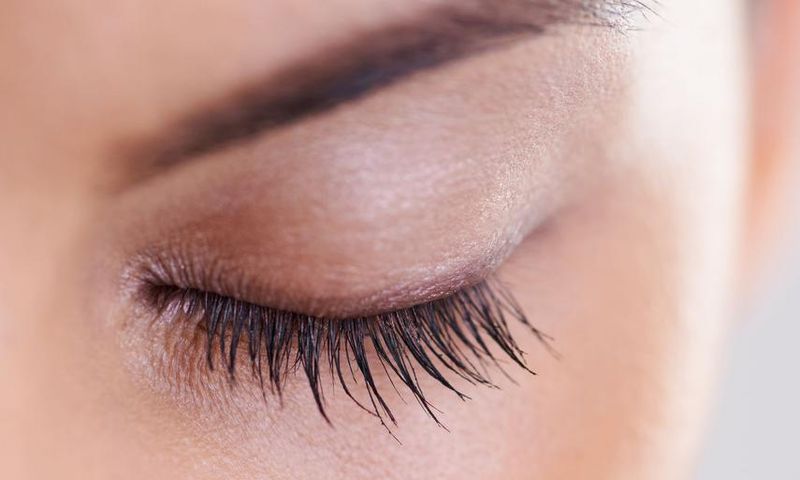 Dr. Pimple Popper Pops Pilar Cyst On An Eyelid