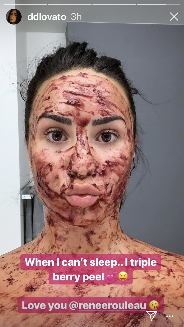 Demi Lovato Shares Chemical Peel Selfie