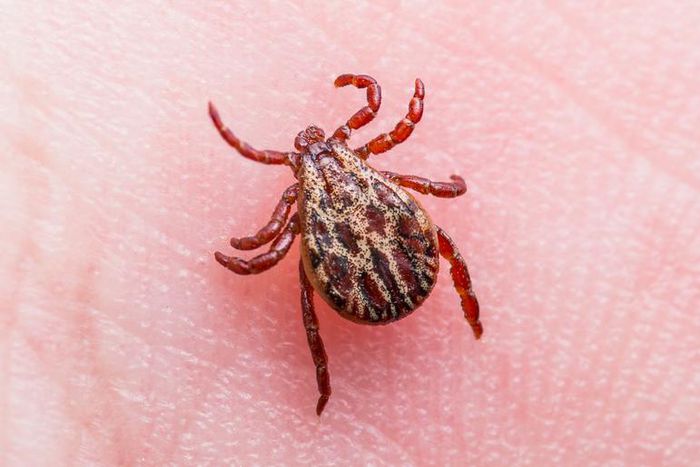 Dr. Pimple Popper Extracts A Blackhead On Earlobe