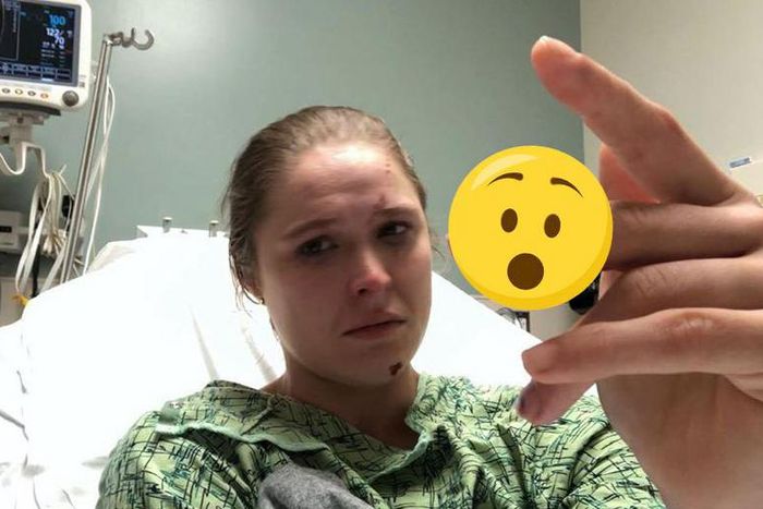 Ronda Rousey Just Narrowly Avoided Losing a Finger