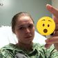 Ronda Rousey Just Narrowly Avoided Losing a Finger