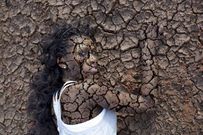 Dry-skin