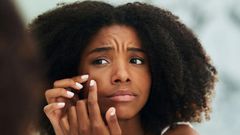 12 Bumps On Your Skin That You Should NEVER Pop