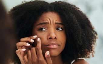 12 Bumps On Your Skin That You Should NEVER Pop
