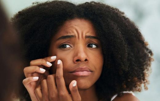 12 Bumps On Your Skin That You Should NEVER Pop