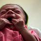 An infant suffering from malnutrition in a hospital in Yemen: a UN report said that 821 million people suffered from hunger, food insecurity and malnutrition in 2018