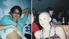 I Was Diagnosed With Ovarian Cancer When I Was 17