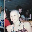 I Was Diagnosed With Ovarian Cancer When I Was 17