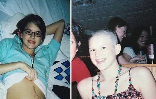 I Was Diagnosed With Ovarian Cancer When I Was 17