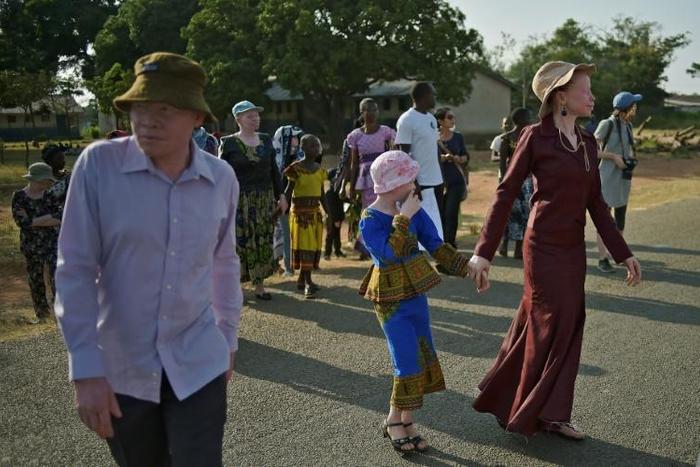 Albinos are killed regularly in some African countries for their body parts for use in witchcraft rituals. Tanzania's Ukerewe island in Lake Victoria, shown here, is seen as a safe place for albinos
