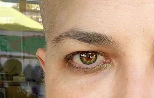 Selma Blair Says She's Got 'Peach Fuzz'