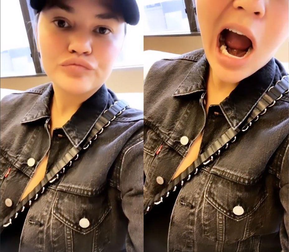 Chrissy Teigen's Tooth Fell Out