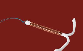 Can You Get Pregnant With An IUD?