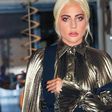 Lady Gaga Shares X-Ray Photos