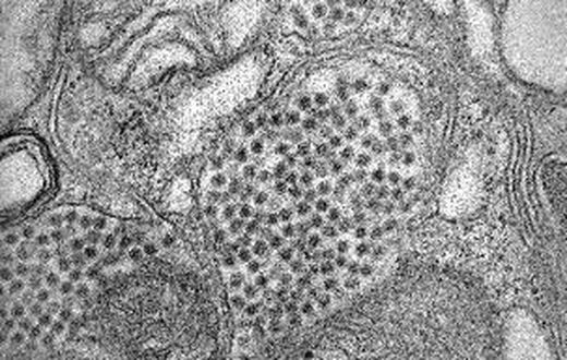 States Warn Residents About Mosquito-Borne Illness That Has Killed 5