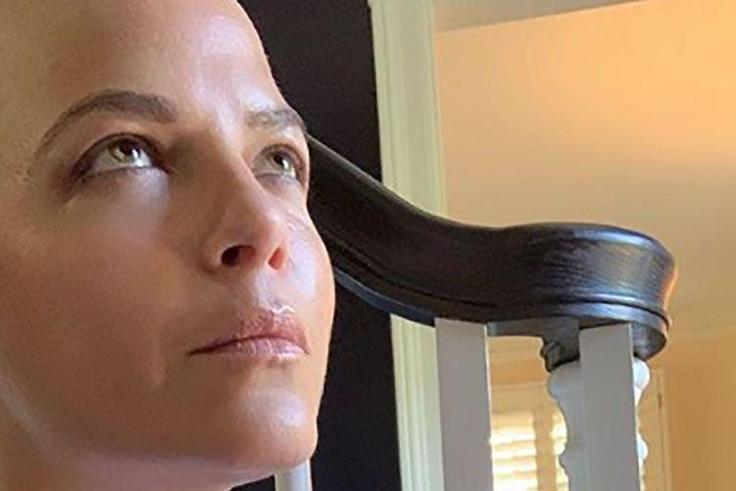 Selma Blair Reveals New MS Treatment Symptom