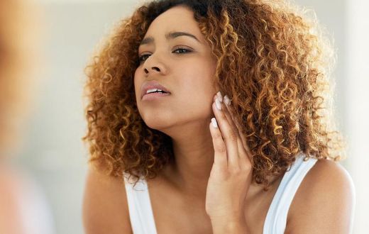 5 Reasons You're Suddenly Getting Chin Hair