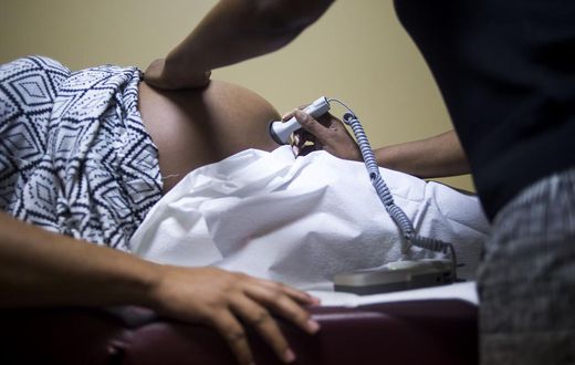 Huge Racial Disparities in Deaths Linked to Pregnancy