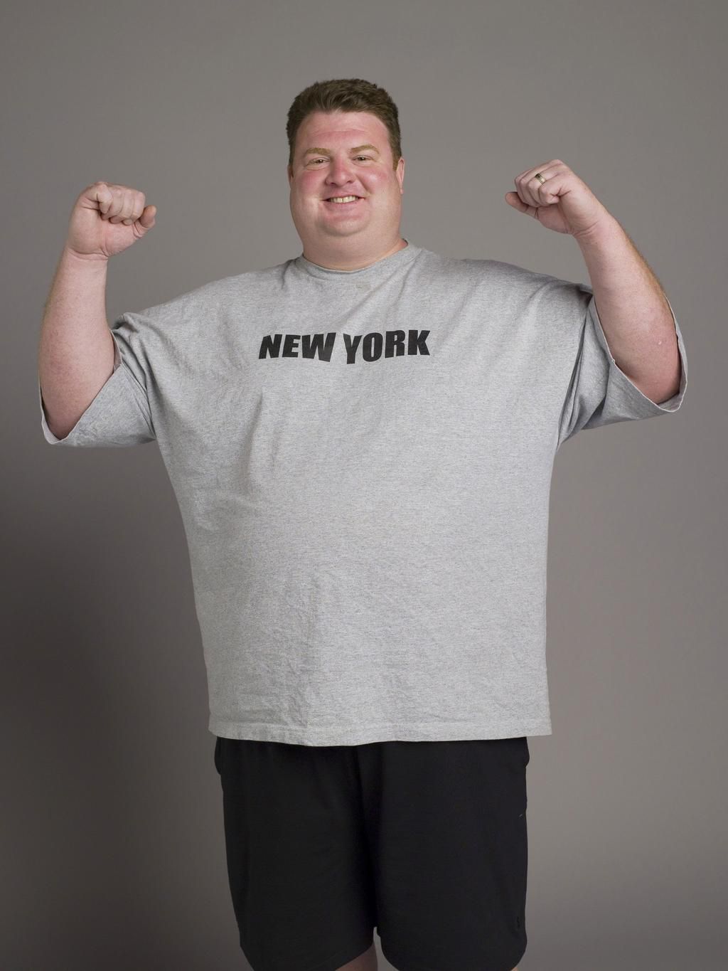 The Most Dramatic 'Biggest Loser' Transformations of All Time