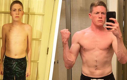 This Man Managed Crohn's Disease and Got Strong