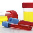 Causes of blood in urine(healthhearty)