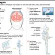 Explanation of a new medical technology, using robotic arms and legs, which enabled a paralysed French man to walk again, with a harness, and move his arms.