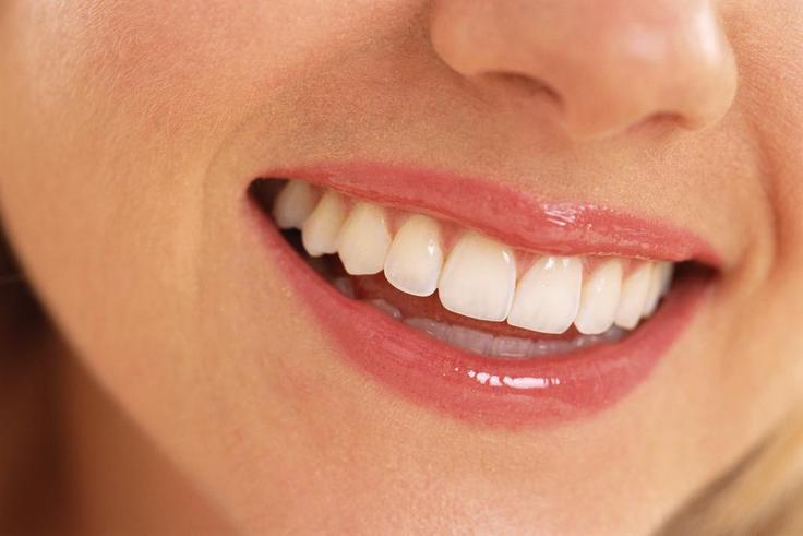 Snow teeth whitening