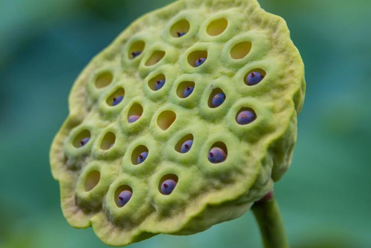 Dr. Pimple Popper Pops Huge Back Blackhead