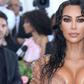 What Does Kim's Positive Lupus Test Mean?