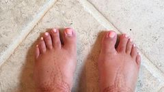 swollen feet(Bloglovin)