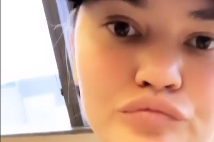 Chrissy Teigen's Tooth Fell Out