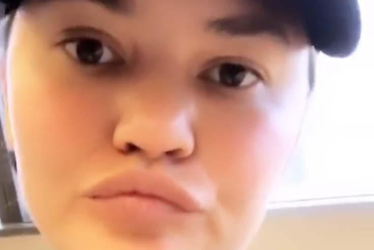Chrissy Teigen's Tooth Fell Out