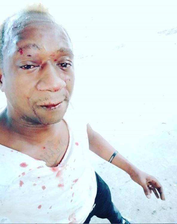 Singer TID hospitalized after being attacked