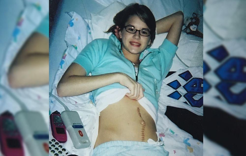 ovarian cancer