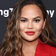 Chrissy Teigen Rubbed Aloe On 'Red Blotchies'