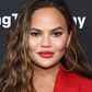 Chrissy Teigen Rubbed Aloe On 'Red Blotchies'