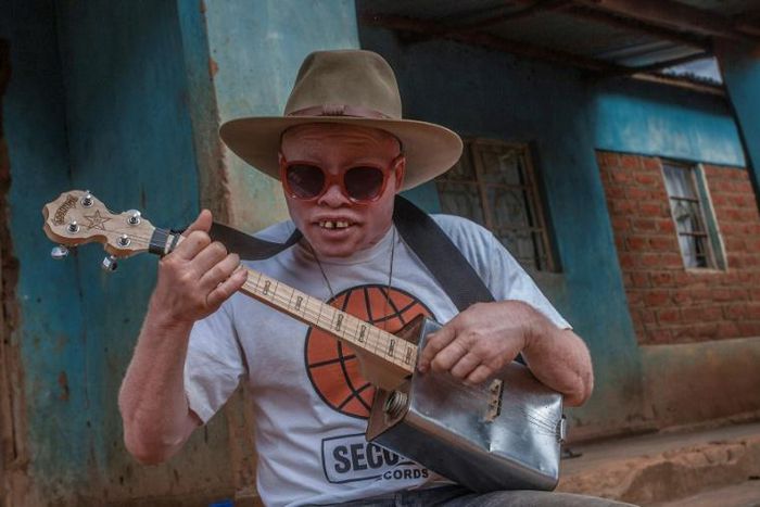 Malawi's musician with albinoism Lazarus Chigwandali practices his guitar and drum in front of his children before leaving his home to perform on the streets of Lilongwe