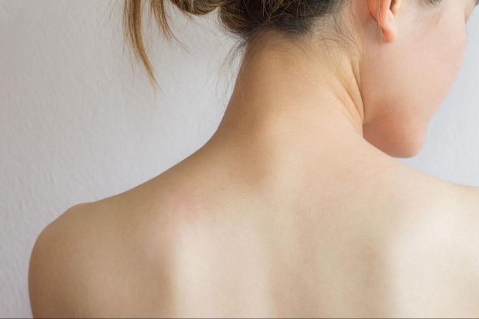 Dr. Pimple Popper Pulls Out Back Lipoma Baby