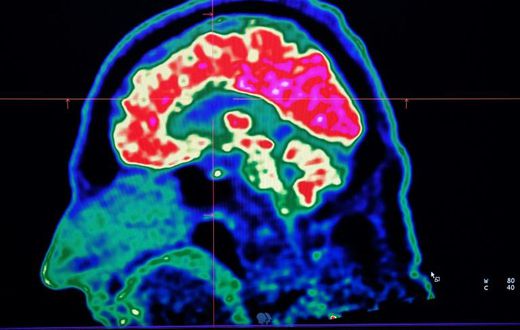 A new study honed in on the brain circuitry responsible for upgrading or downgrading pain signals, likening the mechanism to how a home thermostat controls room temperature