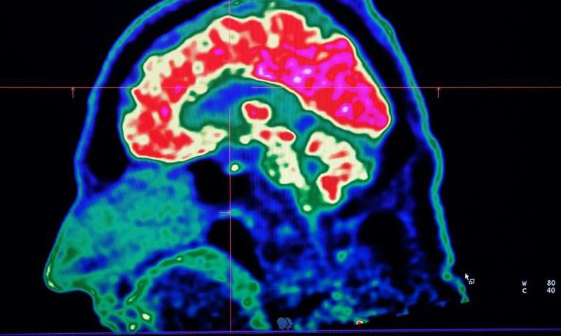 A new study honed in on the brain circuitry responsible for upgrading or downgrading pain signals, likening the mechanism to how a home thermostat controls room temperature