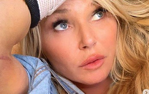 Christie Brinkley Just Posted Her X-Ray Photos