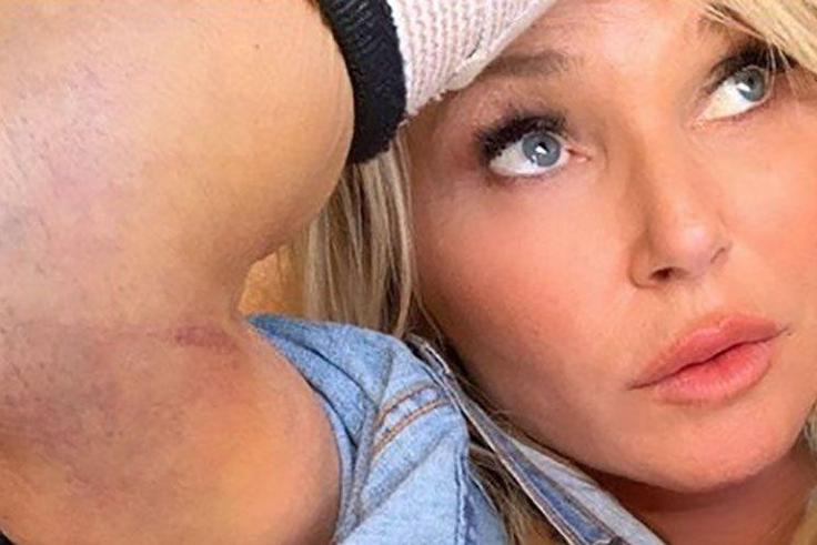 Christie Brinkley Just Posted Her X-Ray Photos