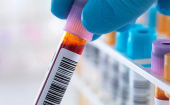 5 Questions You Should Ask About Your Test Results