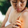 6 Types Of Bug Bites You Never Want To Ignore