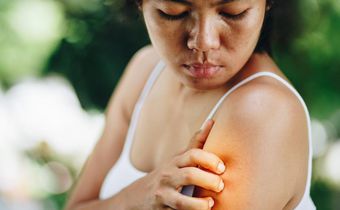6 Types Of Bug Bites You Never Want To Ignore