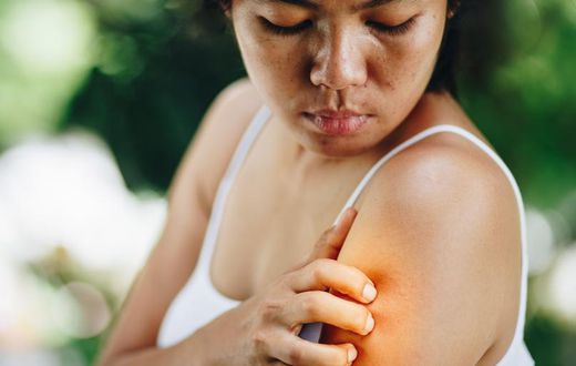 6 Types Of Bug Bites You Never Want To Ignore
