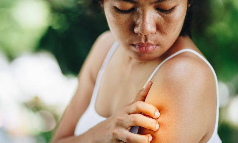 6 Types Of Bug Bites You Never Want To Ignore