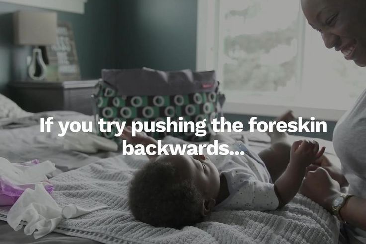 How to Clean Your Baby Boy’s Genitals