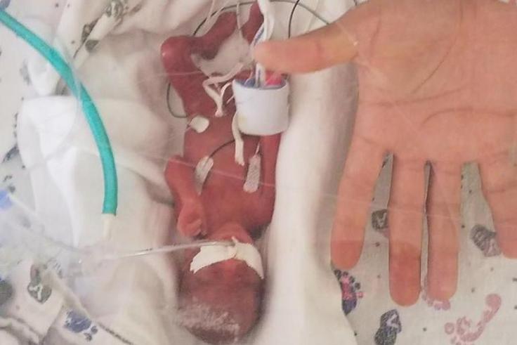 Iowa Mom Gives Birth 4 Months Early