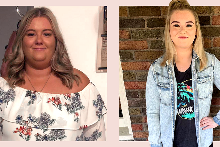 'I Lost 110 Pounds After Weight-Loss Surgery'